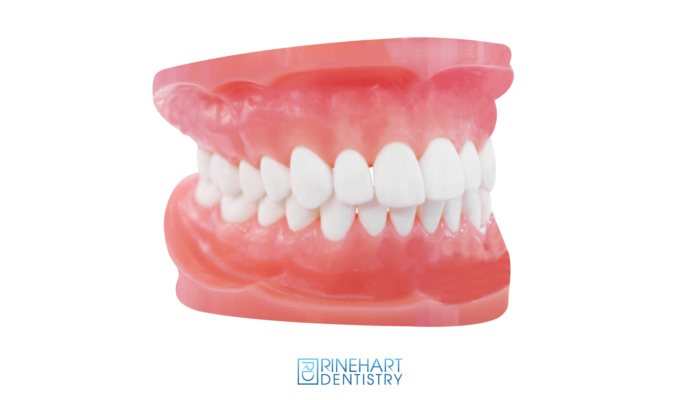 RD_Services_Dentures4